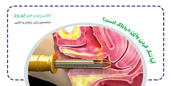 آیا تنگ کردن واژن دردناک است؟