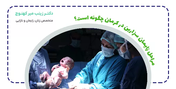 مراحل زایمان سزارین در کرمان چگونه است؟