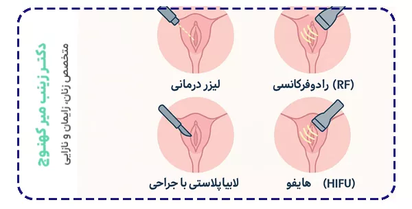 روش های جوانسازی واژن