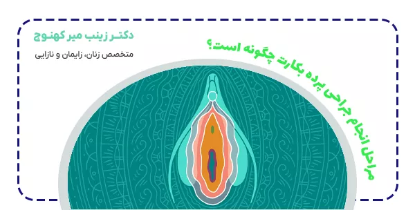 مراحل انجام جراحی پرده بکارت چگونه است؟