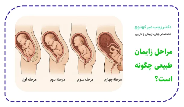 مراحل زایمان طبیعی چگونه است؟