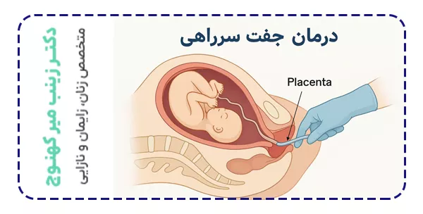 درمان جفت سرراهی