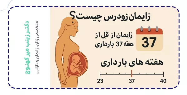 زایمان زودرس چیست