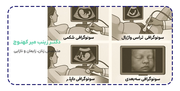 انواع سونوگرافی بارداری