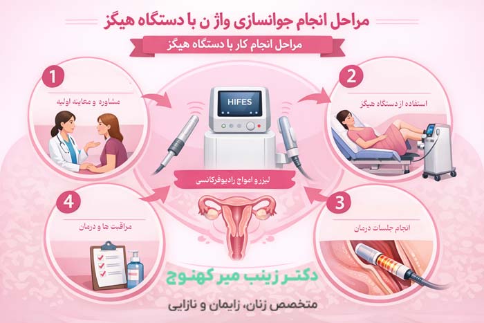 مراحل جوانسازی واژن با هیگز