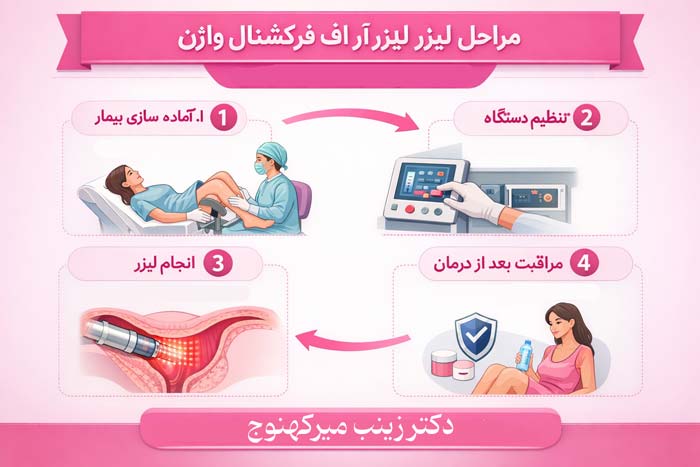 مراحل لیزر آنجلا واژن