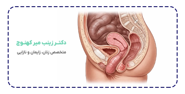 افتادگی رحم چیست